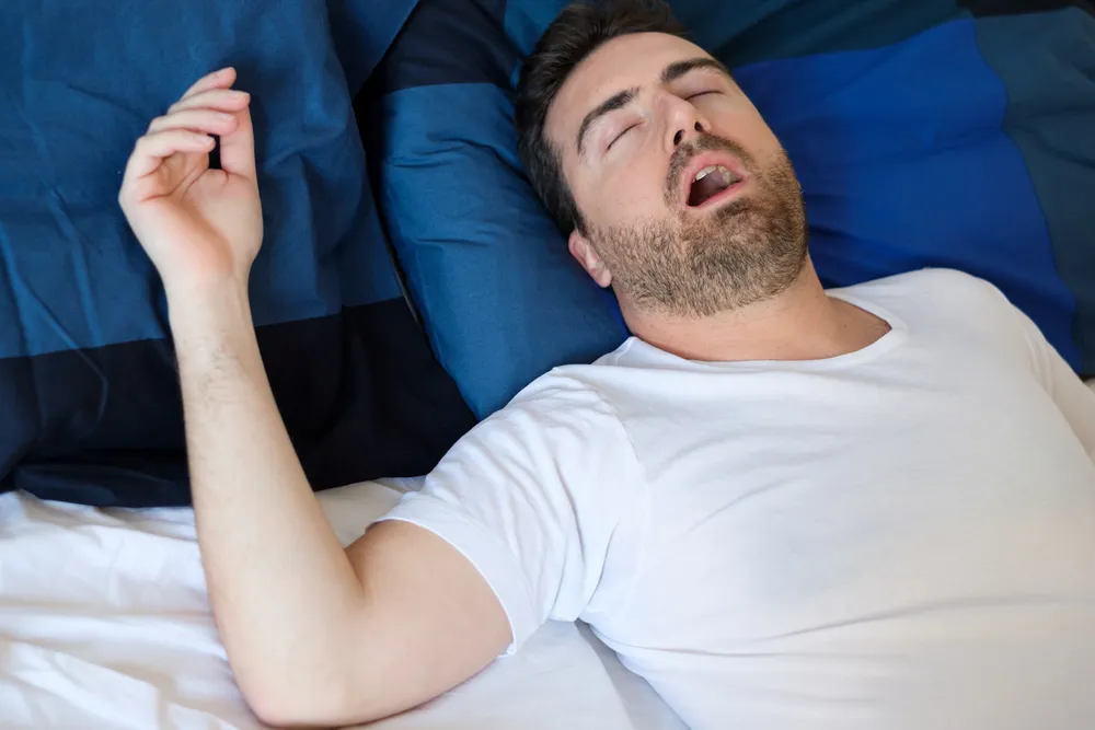 Signos de apnea del sueño
