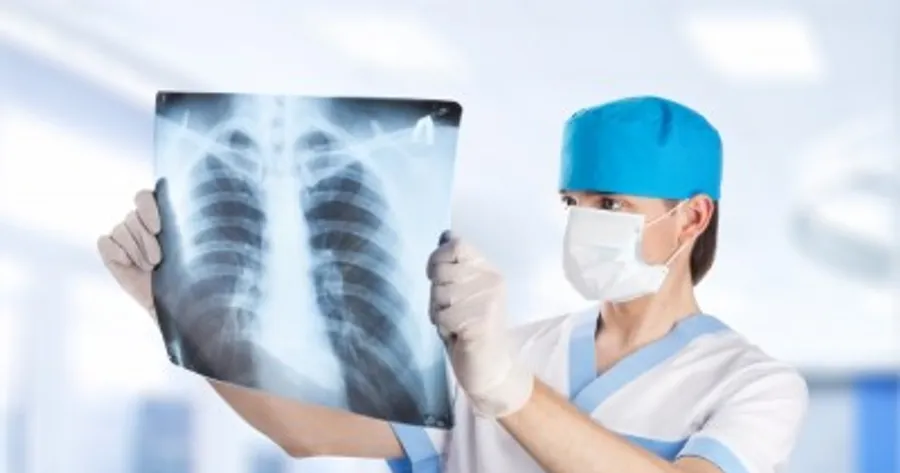Symptômes et facteurs à risque de la tuberculose