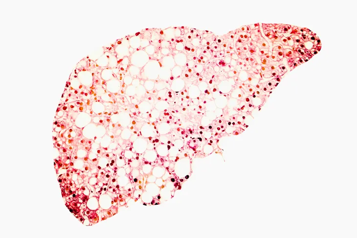 Causes of Liver Disease and Liver Failure - ActiveBeat - Your