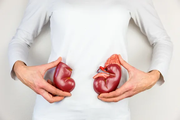 Popular Home Remedies for Kidney Infections