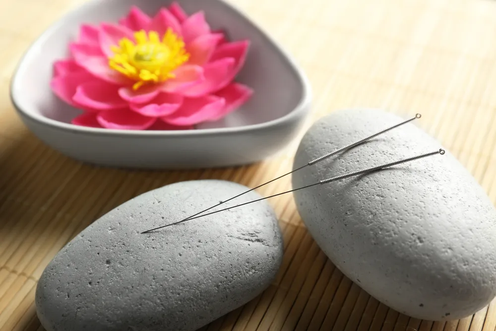 6 Health Conditions Acupuncture Can Help