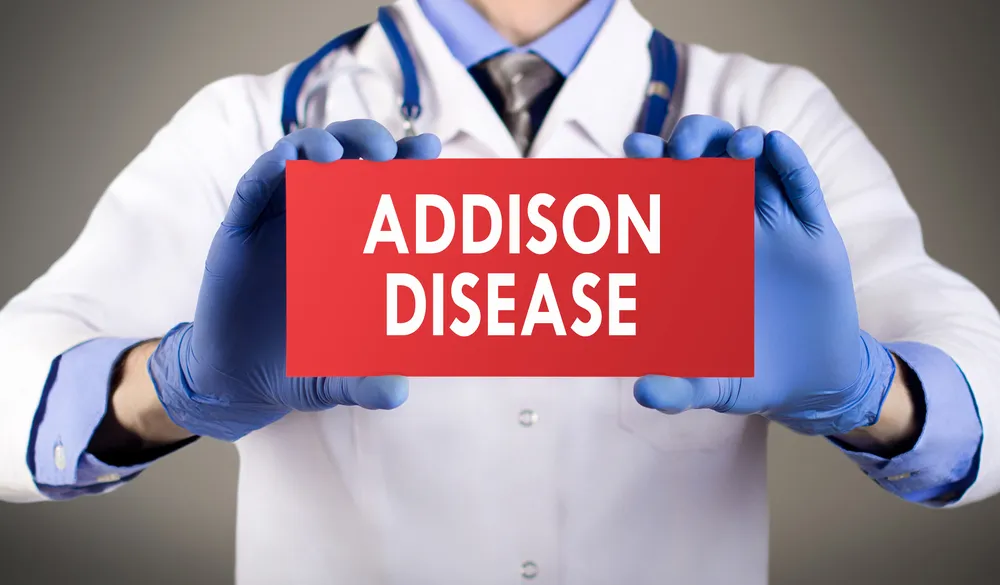 Addison’s Disease: Symptoms, Causes, and Treatment