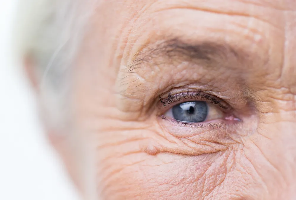 Reasons Your Eye Color Might Change