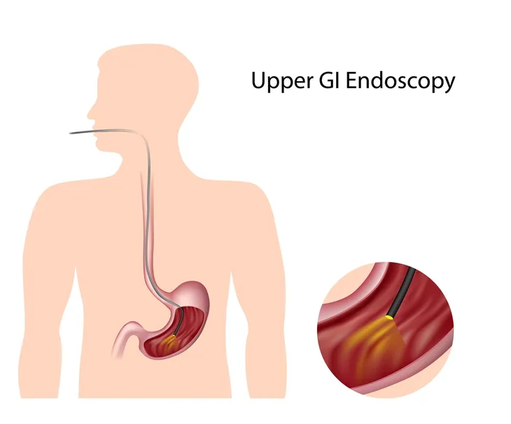 11 Signs and Symptoms of a Kidney Infection – ActiveBeat – Your Daily Dose  of Health Headlines