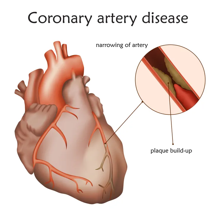 Heart Health