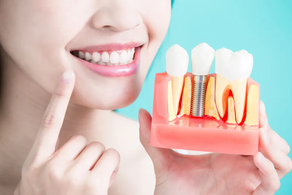 Dental Implant Surgery: Step by Step and the Results