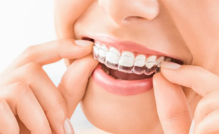 Pros and Cons of Invisalign Braces