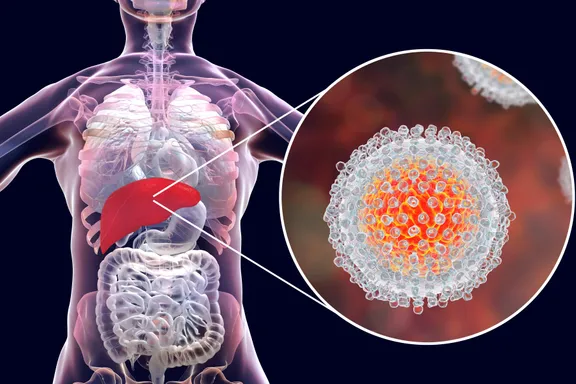 Hepatitis C: Facts You Should Know