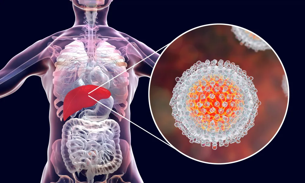 Hepatitis C: Facts You Should Know