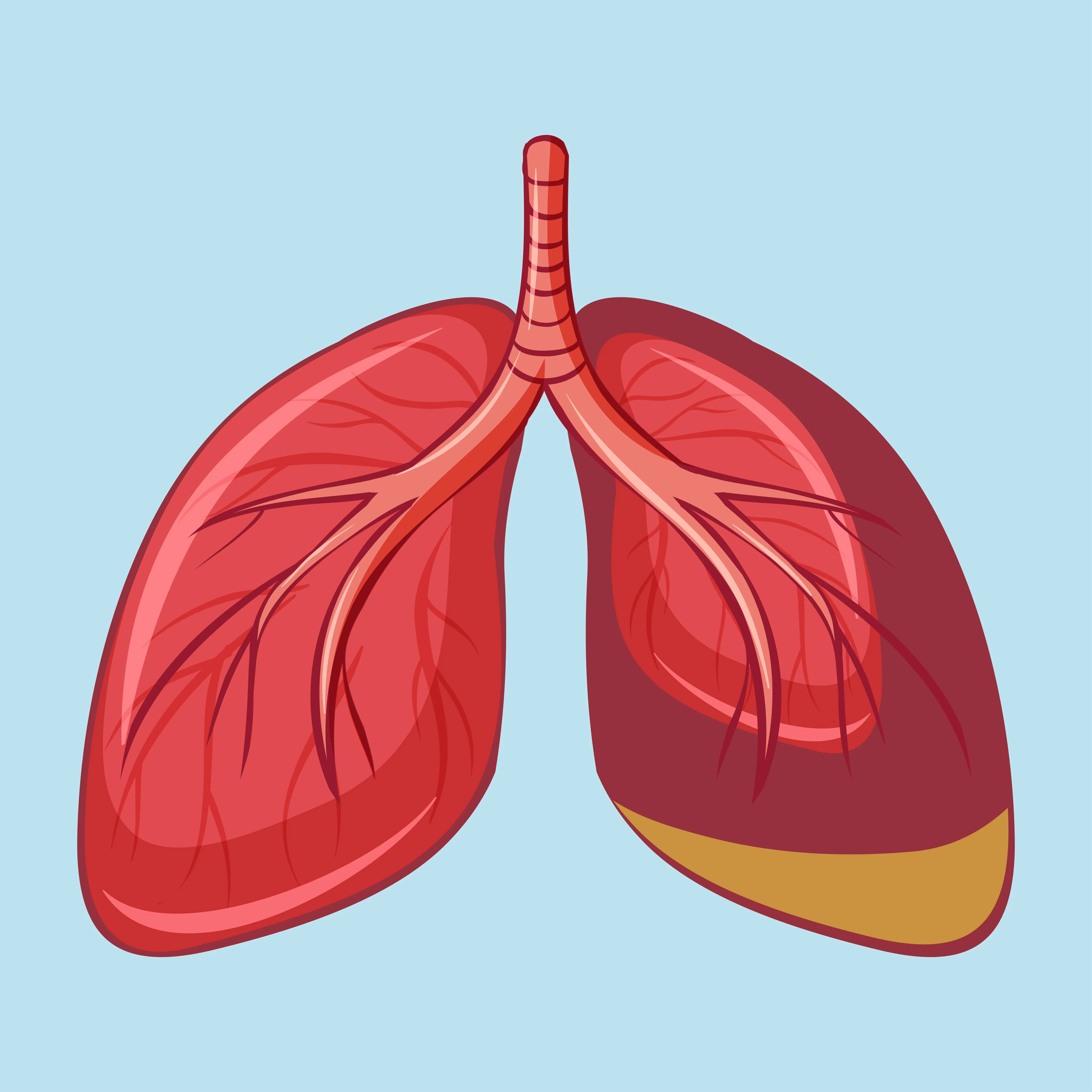 Mesothelioma: Symptoms, Causes, Diagnosis and Treatment