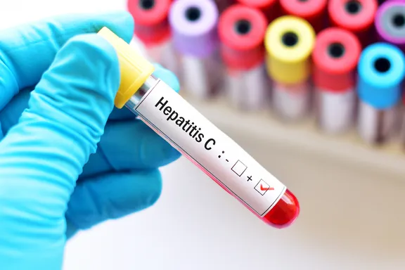 Important Facts About Hepatitis C
