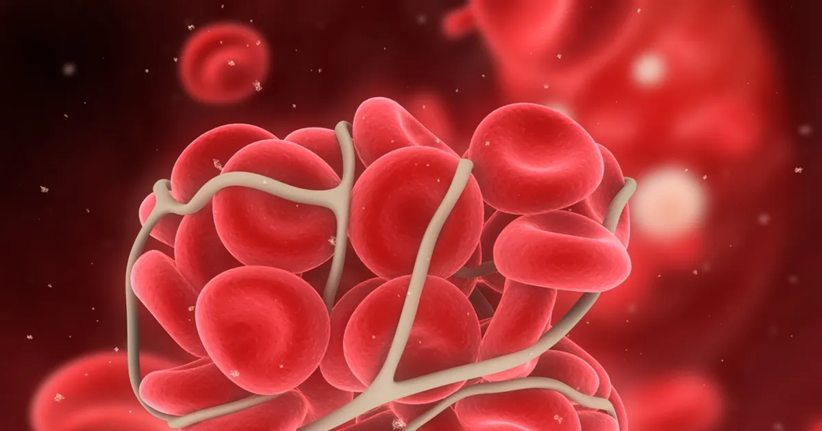 Health Facts to Know About Blood Clots ActiveBeat Your Daily Dose