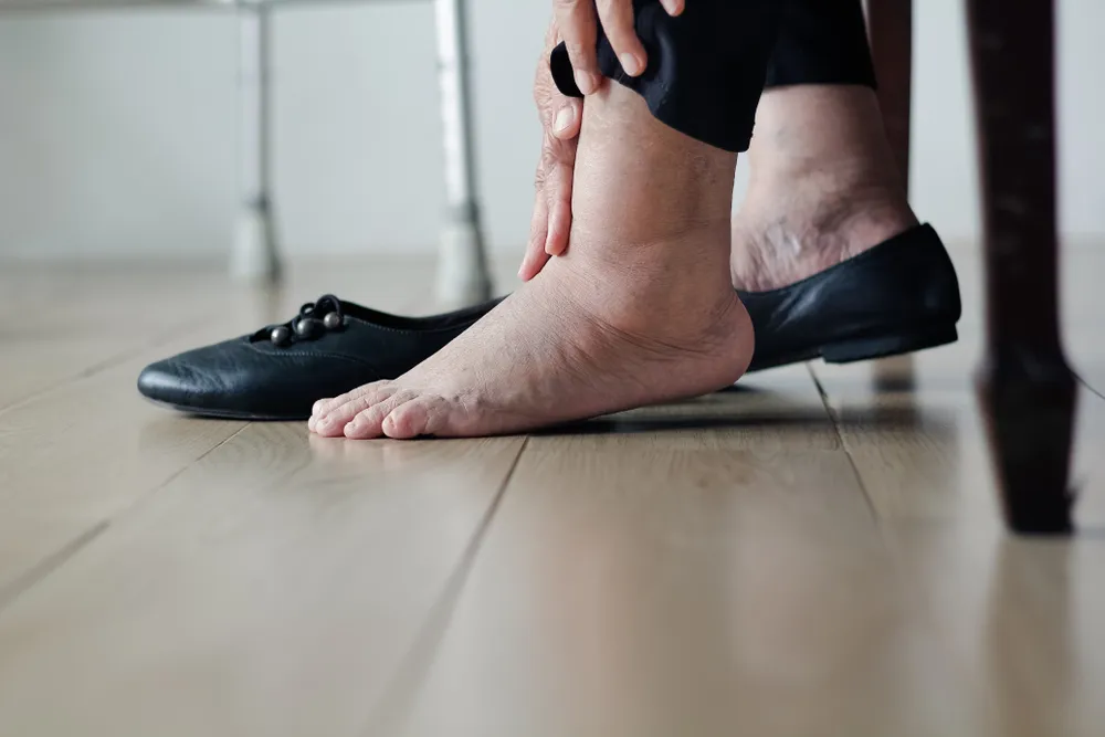 Common Causes of Swollen Feet