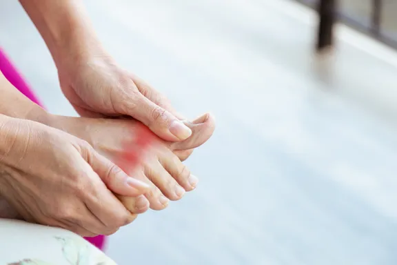 Gout Crystals: What Are They and What to Do About Them