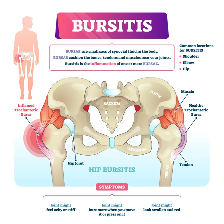 common-causes-of-hip-pain-in-seniors-activebeat-your-daily-dose-of