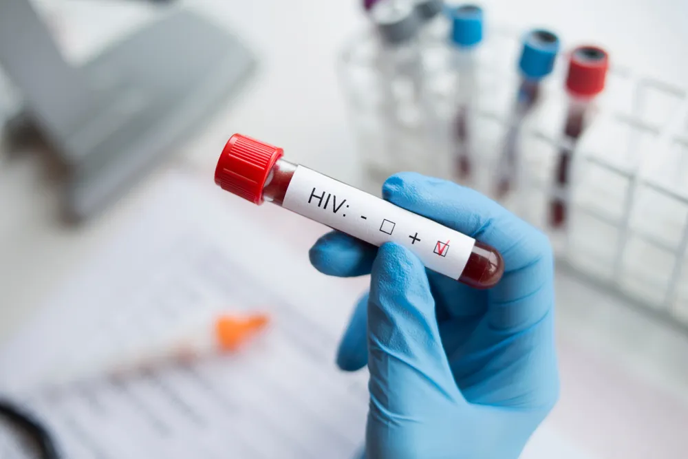 Understanding How HIV Antiretroviral Treatment Saves Lives