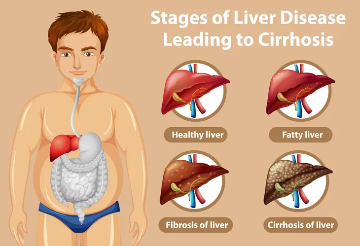 Effects On Your Liver When You Stop Drinking