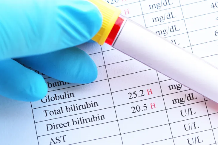 normal bilirubin levels in adults