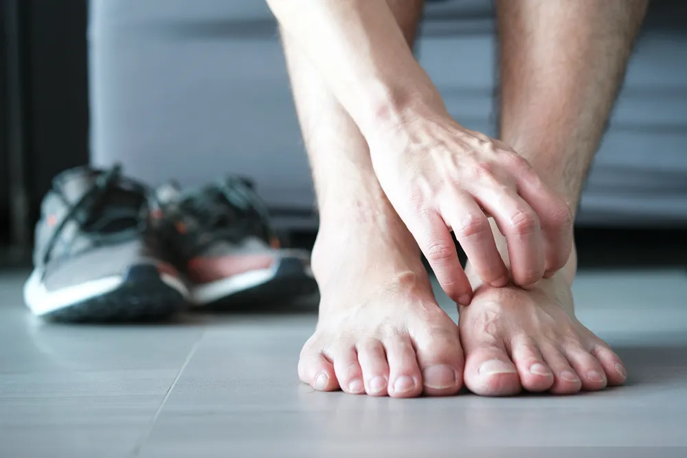 Athlete’s Foot: Types, Symptoms, Causes, and Treatments