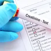How to Lower Creatinine Levels Fast