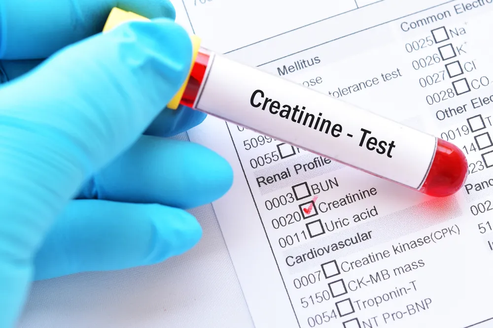 How to Lower Creatinine Levels Fast