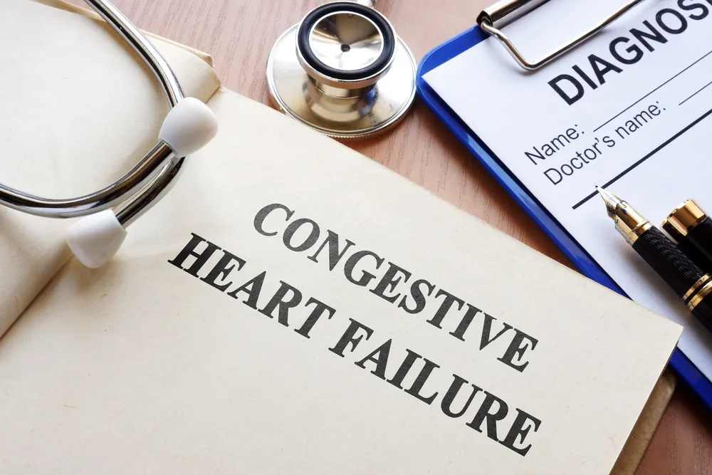 Congestive Heart Failure: The 4 Stages, Symptoms, and Causes