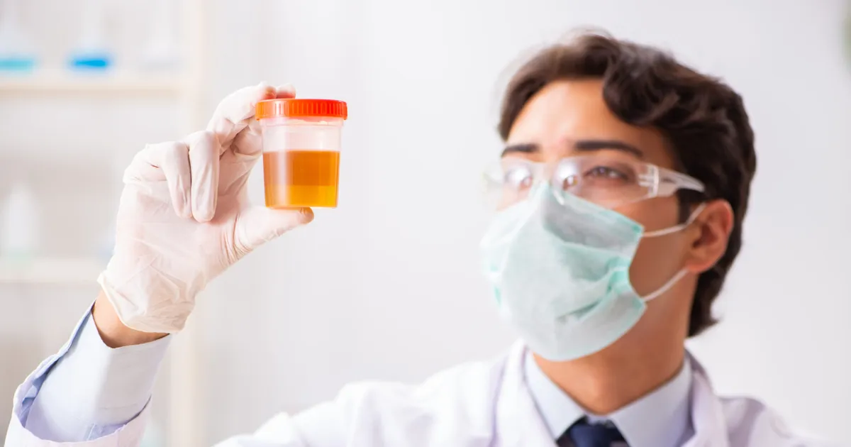 Hématurie Causes de la présence de sang dans les urines ActiveBeat Your Daily Dose of
