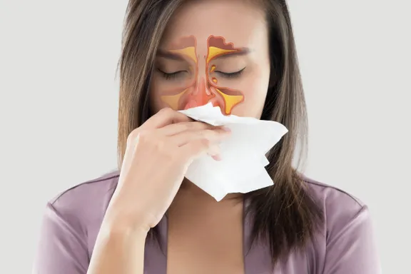 Everything You Need to Know About The Sinuses