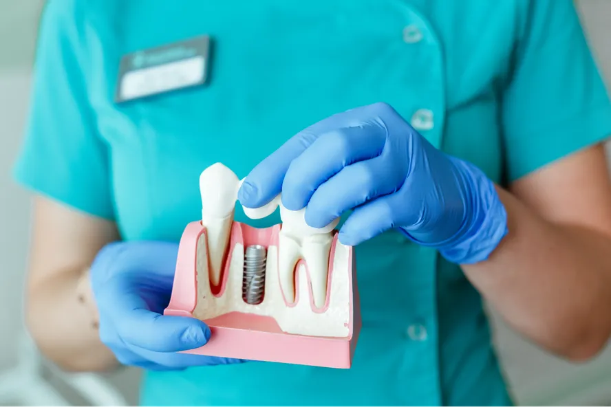 Surprisingly Affordable Ways to Afford Dental Implants