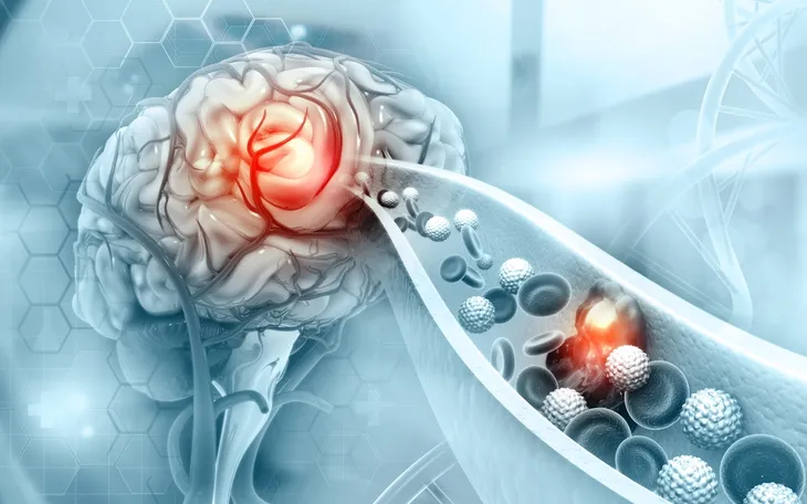 Causes des sensations d'engourdissement et de fourmillement dans ...