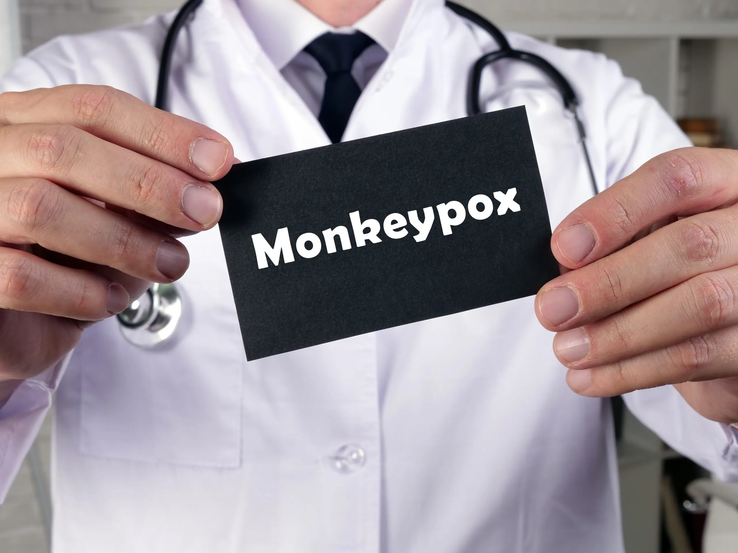 Monkeypox: Symptoms, Causes, and Treatment