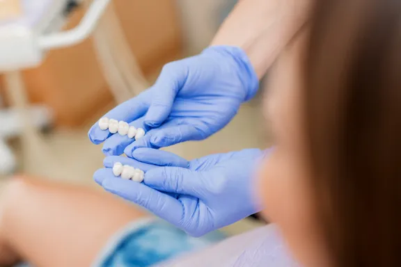 Everything to Know Before Getting Dental Crowns