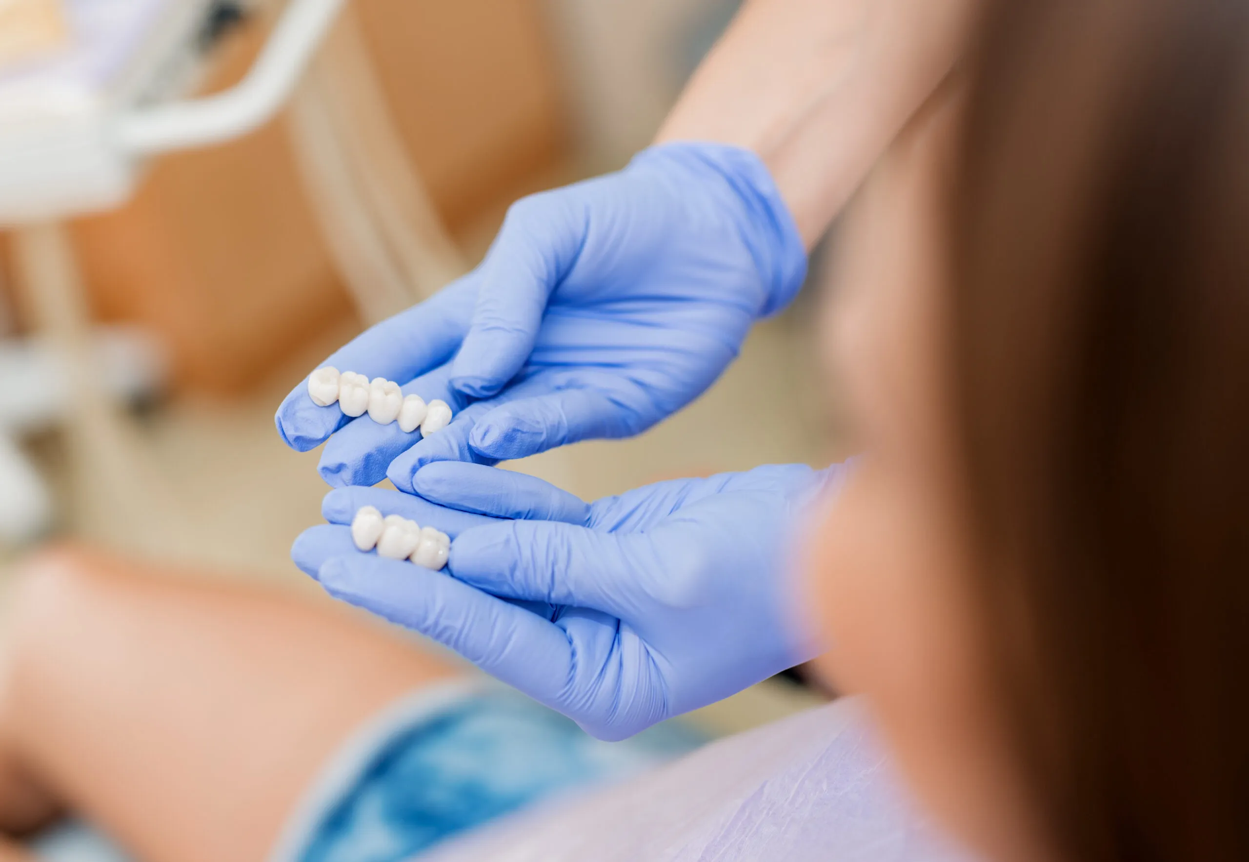 Everything to Know Before Getting Dental Crowns