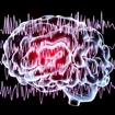 Silent, Subtle and Unseen: How Seizures Happen and Why They're Hard to Diagnose