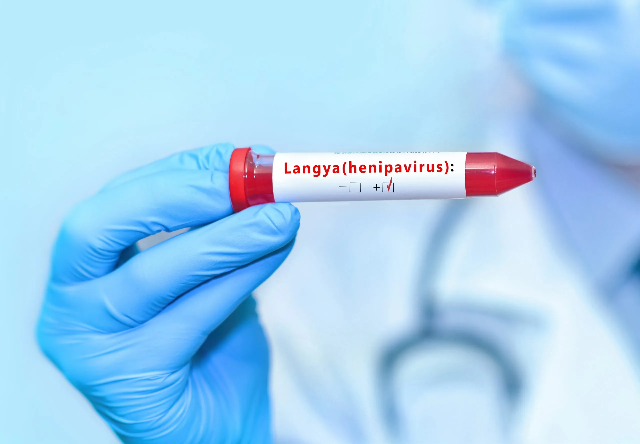 What Is This New Langya Virus? Do We Need to be Worried?