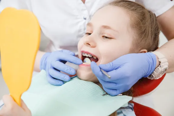 Signs Your Child Needs Braces