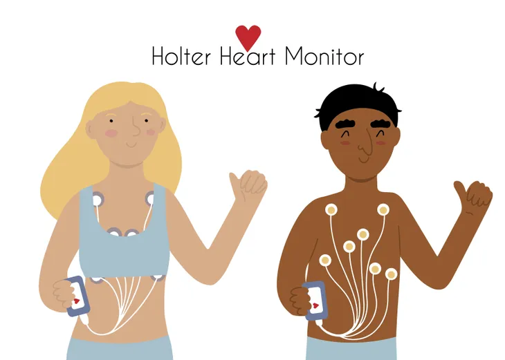 Holter monitor - Mayo Clinic