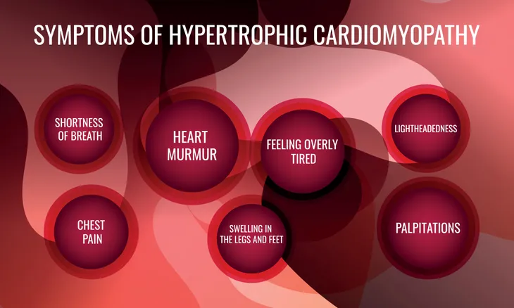 Heart Palpitations: Symptoms, Causes & Treatment