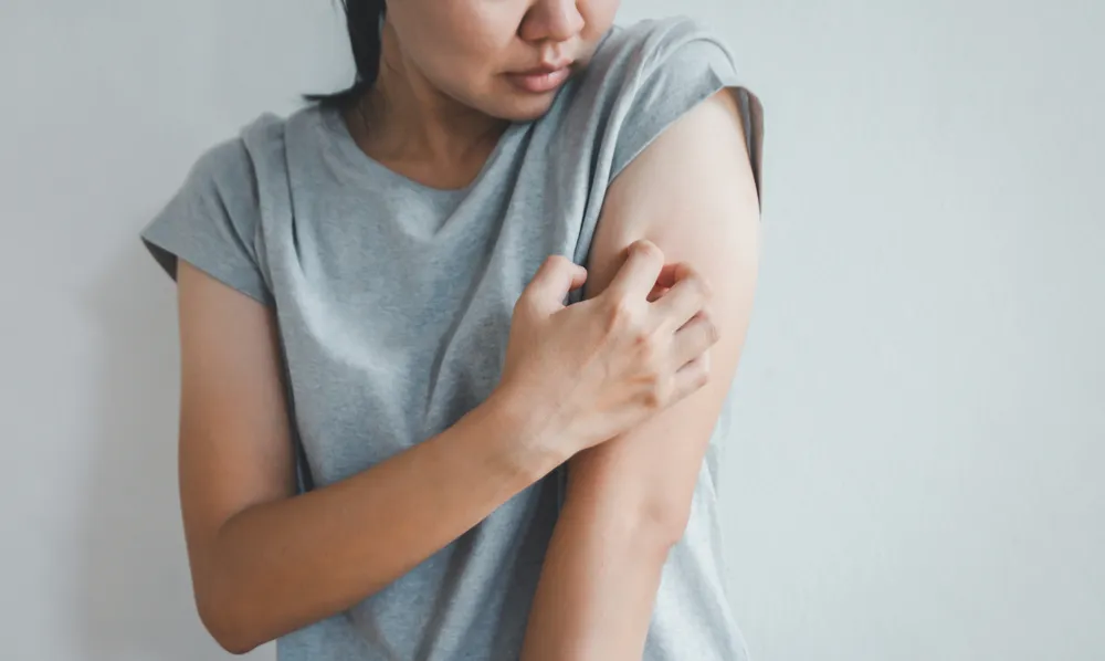 How Can You Effectively Manage Itchy Skin?